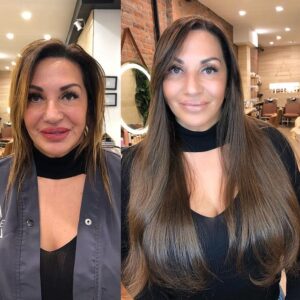 Thinning Hair